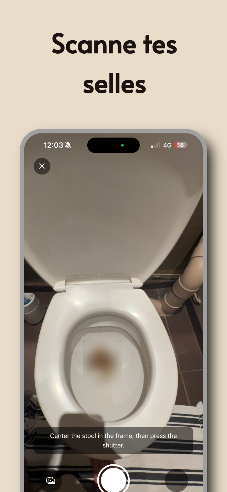 Poop AI — 5